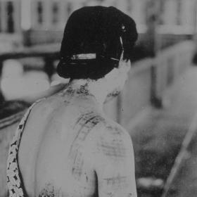 Effects of the Atomic Bomb